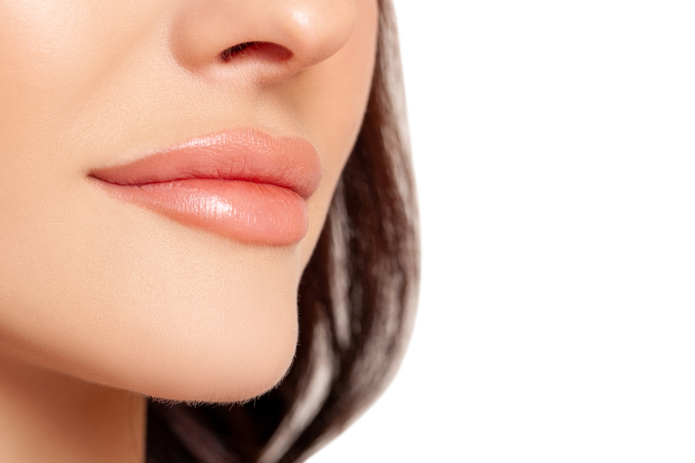 Lips filled with Restylane Kysse