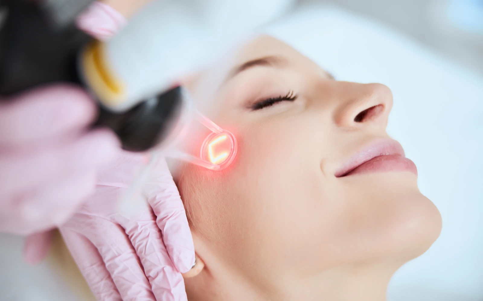 patient during laser resurfacing treatment at medical spa