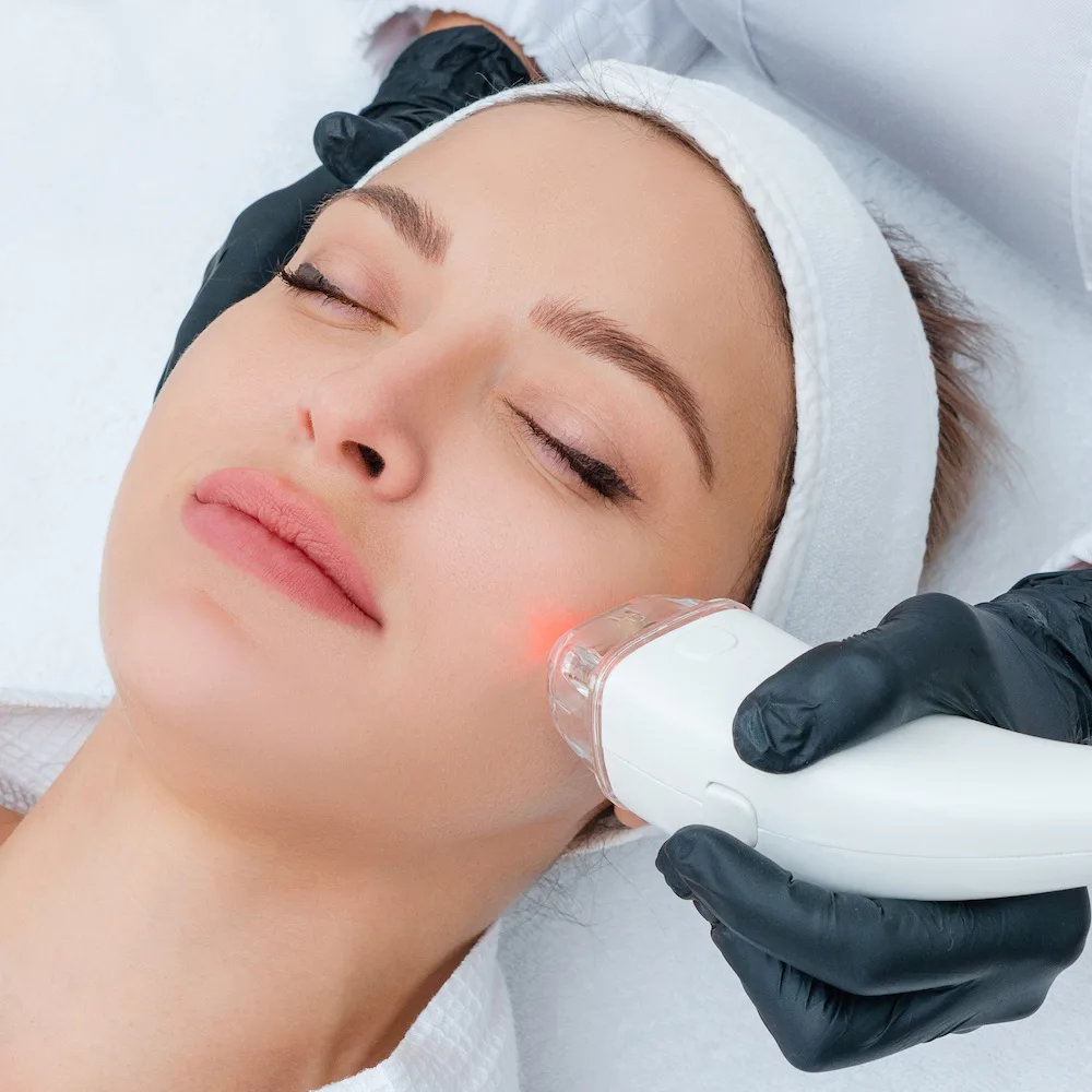 laser skin rejuvenation procedure