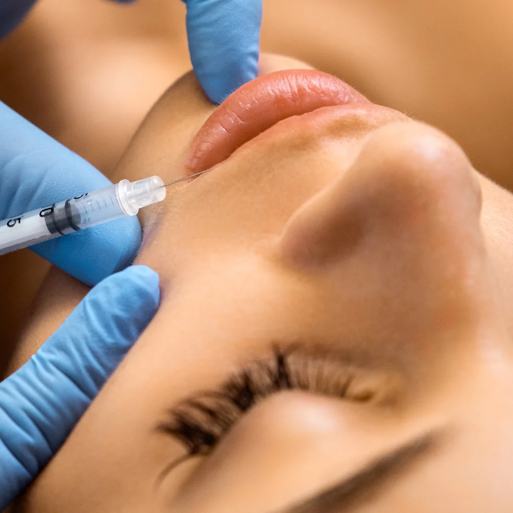 patient during botox lip flip for gummy smile