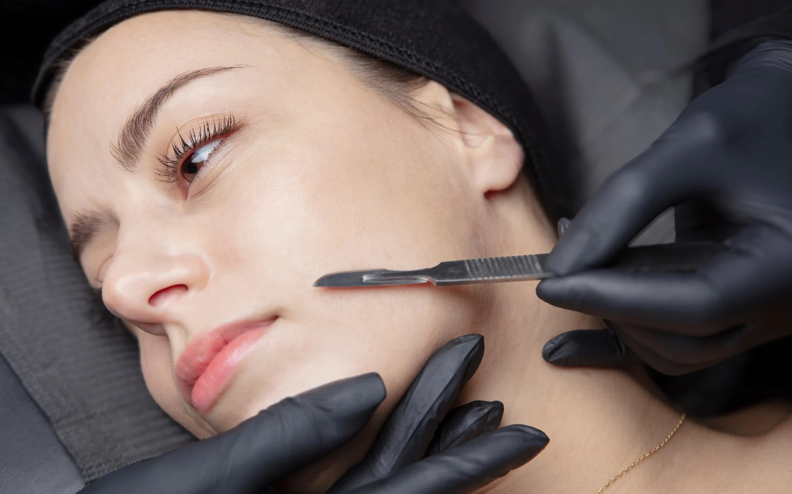 dermaplaning treatment