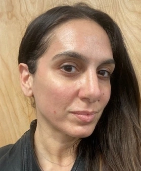 after fraxel laser