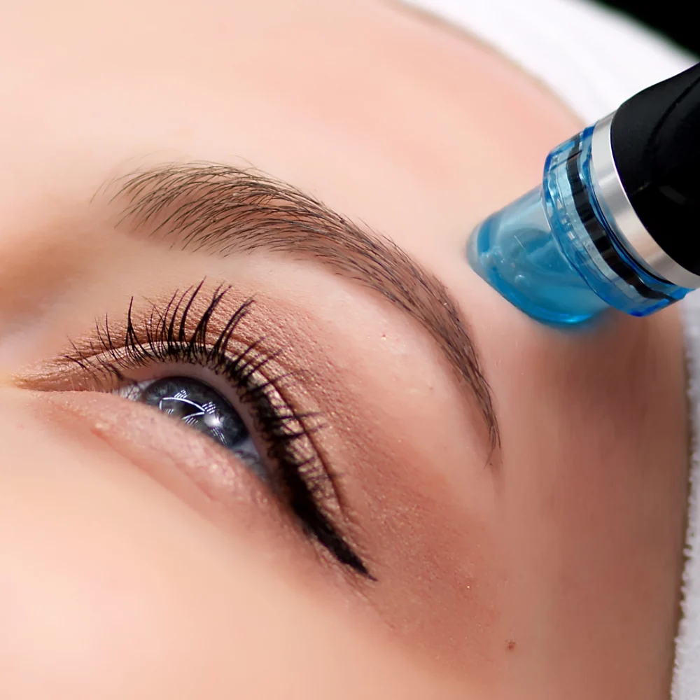 close up of hydrafacial device on patient's skin