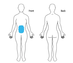 Coolsculpting Elite abdomen