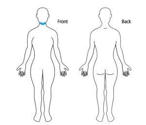 Coolsculpting Elite chin treatment area