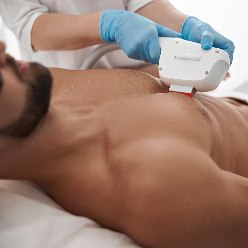 man receiving laser hair removal treatment on chest