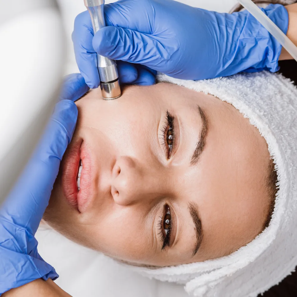 microdermabrasion facial treatment