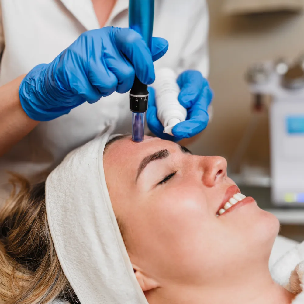 Skinpen microneedling