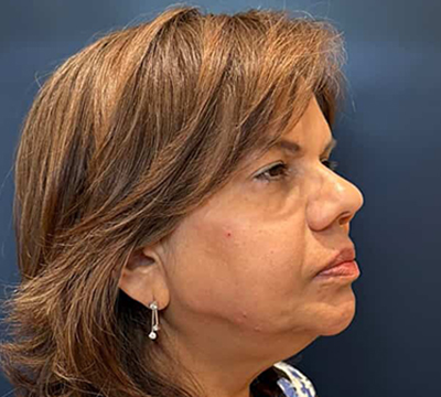 bna image