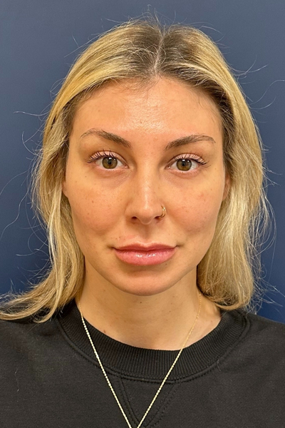Patient 1 before photo