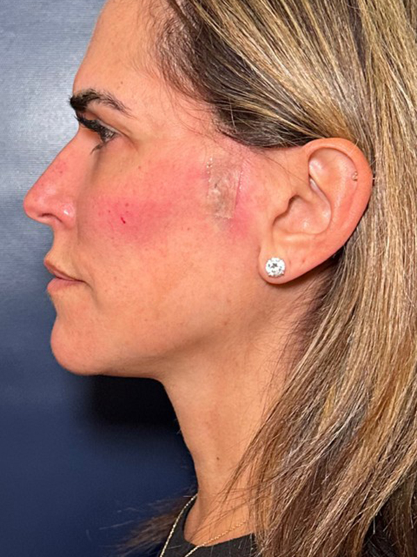 bna image
