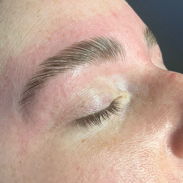 Patient 5 after photo