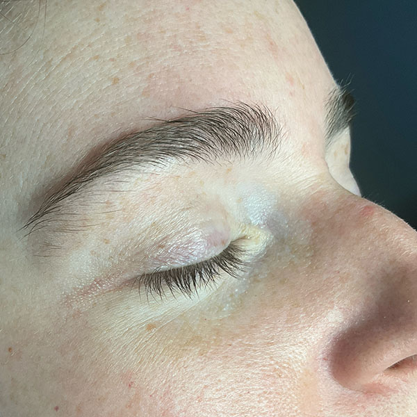 Patient 5 before photo