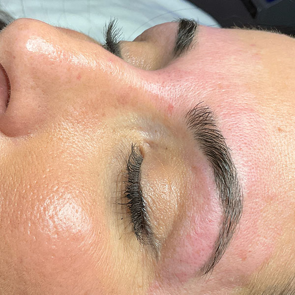 Patient 4 after photo