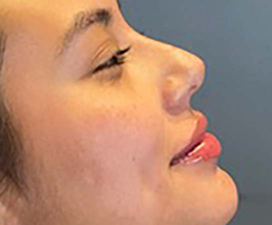 bna image