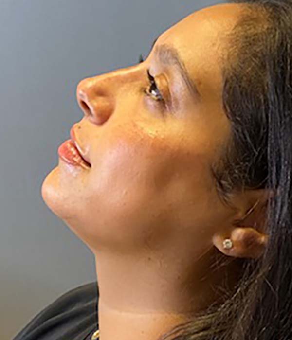 bna image