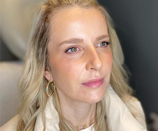 Patient 6 after photo