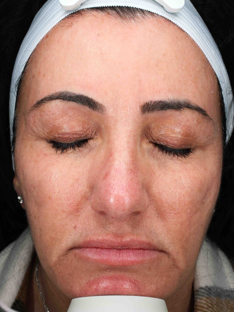 bna image