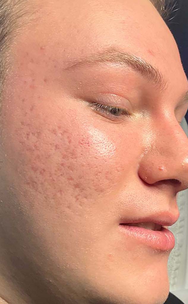 Patient 2 after photo