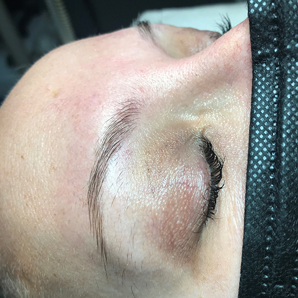 Patient 1 before photo