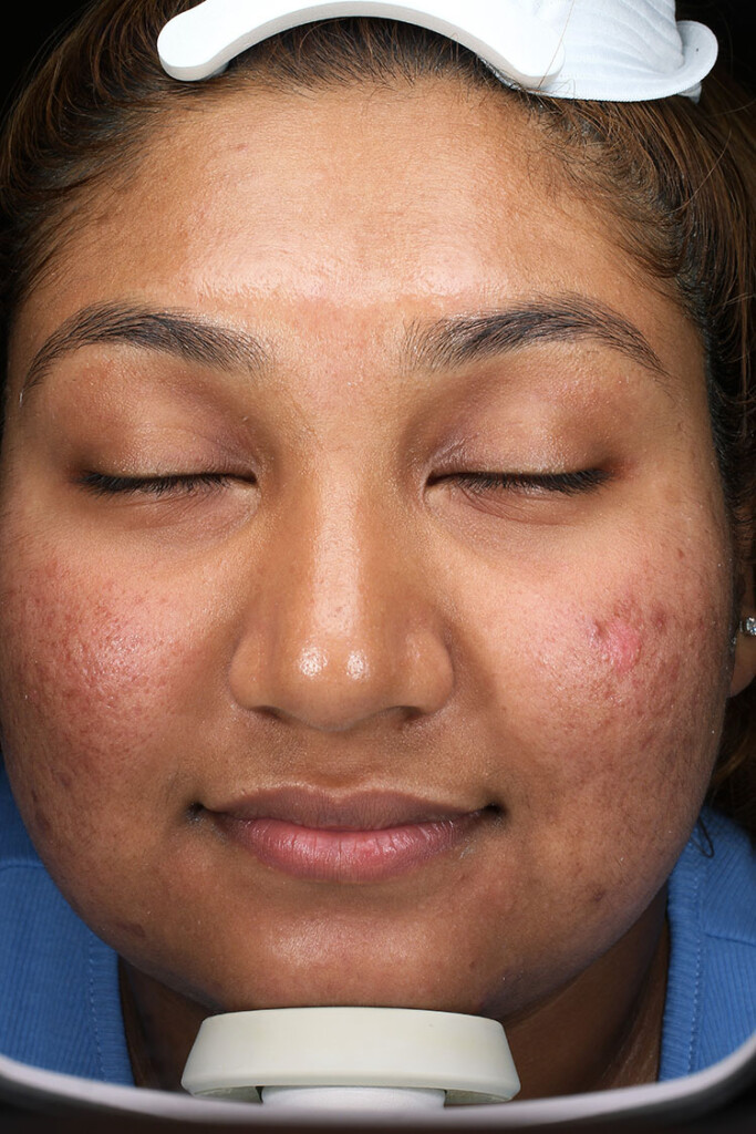 Patient 1 before photo