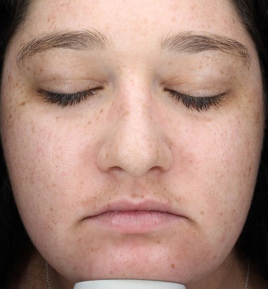 Patient 8 before photo