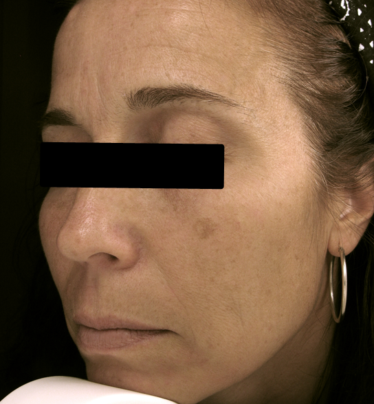  bna image b