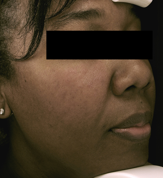  bna image b