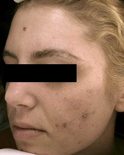 Patient 1 before photo