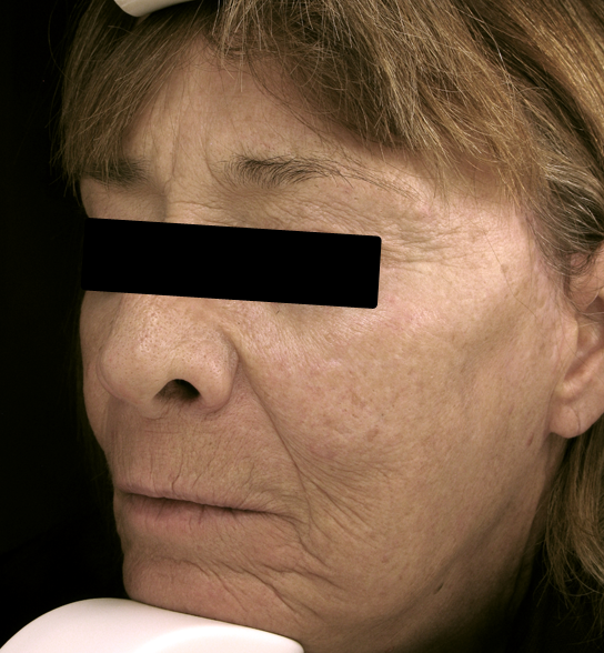 bna image