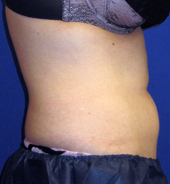  bna image b