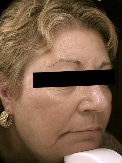 bna image