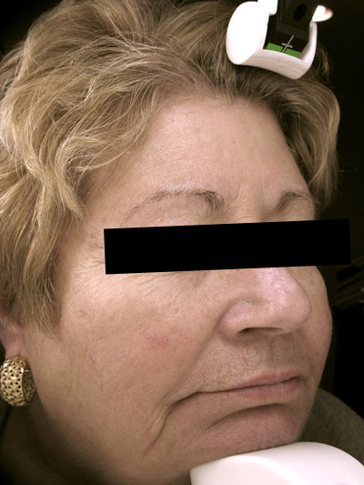  bna image b