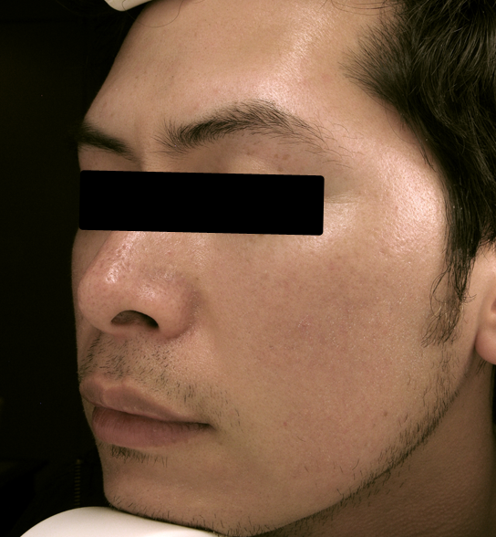 bna image