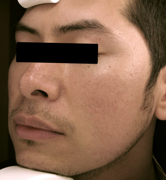  bna image b