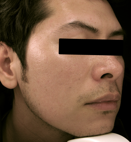 bna image