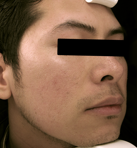  bna image b