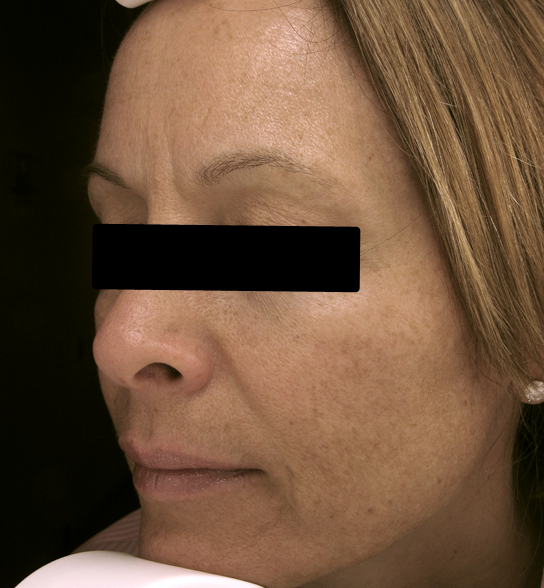  bna image b