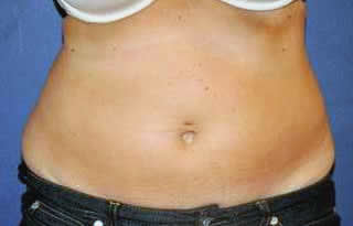 bna image