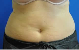  bna image b