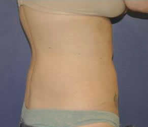 bna image