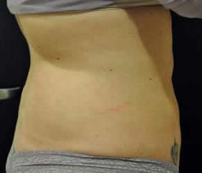  bna image b