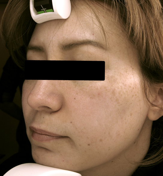  bna image b