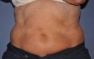 bna image