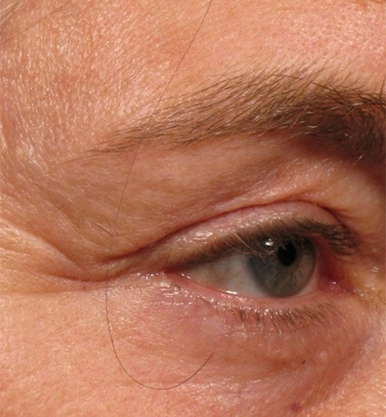  bna image b