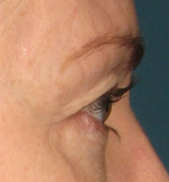 Patient 5 before photo