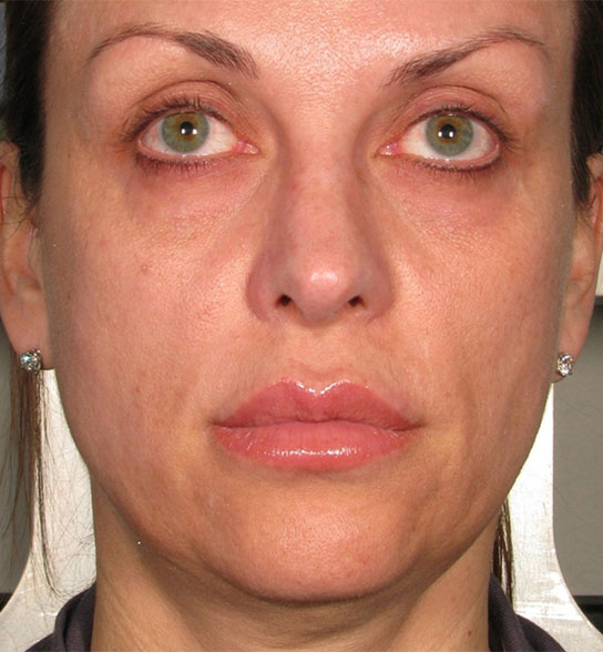 Patient 6 before photo
