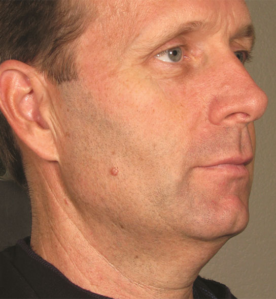 Patient 7 before photo