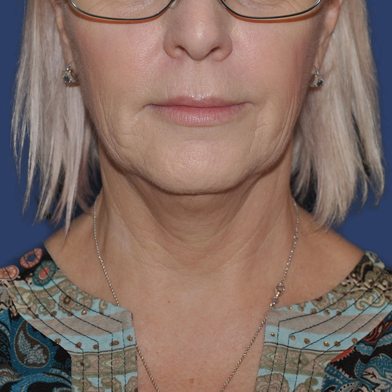  bna image b