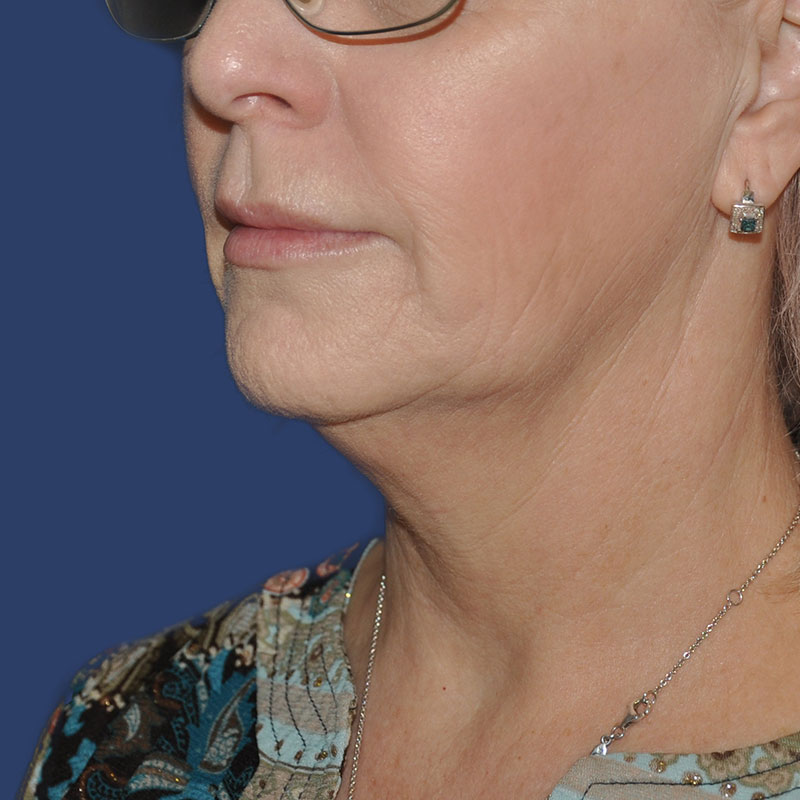  bna image b